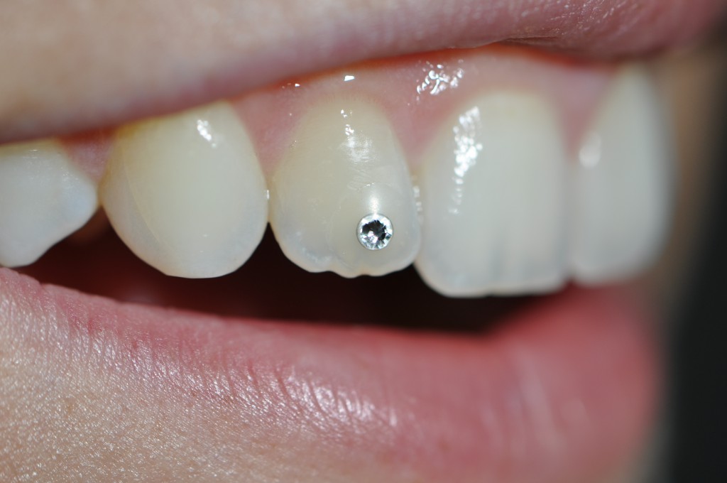 Ästhetische Zahnheilkunde | Zahnarzt Dr. Treuheit Roßtal