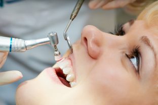 Professionelle Zahnreinigung | Zahnarzt Roßtal Dr. Treuheit